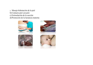 a) Masaje-hidratación de la piel
b) Contacto piel con piel.
c) Estimulación de la succión
d) Promoción de la lactancia materna
 