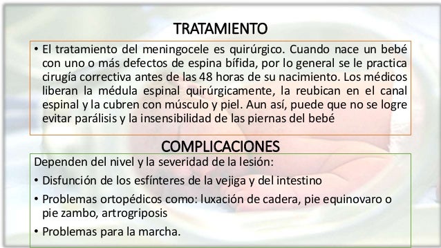 Podmor abejuno del dolor en la espalda