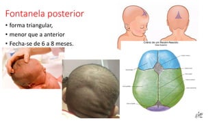 Fontanela posterior
• forma triangular,
• menor que a anterior
• Fecha-se de 6 a 8 meses.
 