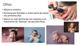Olhos
• Observar simetria .
• Permanecem fechados a maior parte do tempo
nos primeiros dias.
• Abrem-se mais facilmente em resposta a um
movimento de “balanço” do que pela força.
 