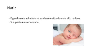 Nariz
• É geralmente achatado na sua base e situado mais alto na face.
• Sua ponta é arredondada.
 