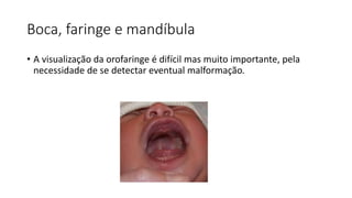 Boca, faringe e mandíbula
• A visualização da orofaringe é difícil mas muito importante, pela
necessidade de se detectar eventual malformação.
 