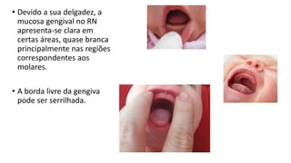 • Devido a sua delgadez, a
mucosa gengival no RN
apresenta-se clara em
certas áreas, quase branca
principalmente nas regiões
correspondentes aos
molares.
• A borda livre da gengiva
pode ser serrilhada.
 