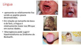 Língua
• apresenta-se relativamente lisa
sendo as papilas pouco
desenvolvidas.
• Em relação ao tamanho da boca
e da face, a língua é
relativamente maior nos RN que
em outras idades.
• Macroglossia pode sugerir
hipotireoidismo ou Síndrome de
Beckwith.
 