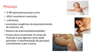 Pescoço
• O RN apresenta pescoço curto,
• difícil reconhecer anomalias
• cretinismo,
• anomalias congênitas do desenvolvimento
da clavícula, etc.
• fibroma do esternocleidomastóideo
• (massa dura encontrada no corpo do
músculo e que algumas vezes pode
perturbar a movimentação do pescoço),
normalmente é pós trauma.
 