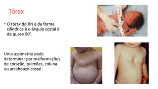 Tórax
• O tórax do RN é de forma
cilíndrica e o ângulo costal é
de quase 90°.
Uma assimetria pode
determinar por malformações
de coração, pulmões, coluna
ou arcabouço costal.
 
