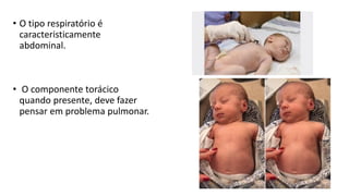 • O tipo respiratório é
caracteristicamente
abdominal.
• O componente torácico
quando presente, deve fazer
pensar em problema pulmonar.
 