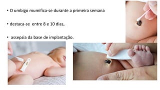 • O umbigo mumifica-se durante a primeira semana
• destaca-se entre 8 e 10 dias,
• assepsia da base de implantação.
 