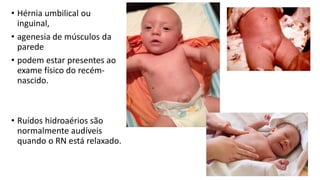 • Hérnia umbilical ou
inguinal,
• agenesia de músculos da
parede
• podem estar presentes ao
exame físico do recém-
nascido.
• Ruídos hidroaérios são
normalmente audíveis
quando o RN está relaxado.
 
