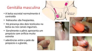 Genitália masculina
• A bolsa escrotal normalmente é
contraída
• hidroceles são freqüentes.
• Há presença dos dois testículos na
bolsa ou nos canais inguinais.
• Geralmente o pênis apresenta um
prepúcio com orifício muito
estreito
• aderências entre a pele do
prepúcio e a glande,
 