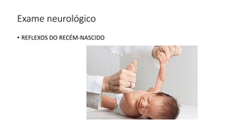 Exame neurológico
• REFLEXOS DO RECÉM-NASCIDO
 