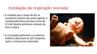 Instalação da respiração neonatal
• A medida que o tórax do Rn se
comprime através do canal vaginal, a
compressão força pra fora cerca de
1/3 do líquido pulmonar através do
nariz e boca.
• A circulação pulmonar e o sistema
linfático absorvem os 2/3 restantes
após o começo da respiração.
 