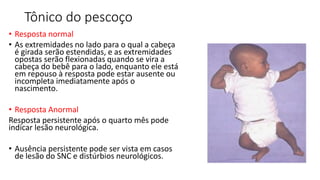 Tônico do pescoço
• Resposta normal
• As extremidades no lado para o qual a cabeça
é girada serão estendidas, e as extremidades
opostas serão flexionadas quando se vira a
cabeça do bebê para o lado, enquanto ele está
em repouso à resposta pode estar ausente ou
incompleta imediatamente após o
nascimento.
• Resposta Anormal
Resposta persistente após o quarto mês pode
indicar lesão neurológica.
• Ausência persistente pode ser vista em casos
de lesão do SNC e distúrbios neurológicos.
 