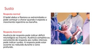 Susto
Resposta normal
O bebê abduz e flexiona as extremidades e
pode começar a chorar quando é exposto a
movimento repentino ou barulho.
Resposta Anormal
Ausência de resposta pode indicar déficit
neurológico ou trauma. Ausência completa ou
consistente de resposta aos ruídos intensos
pode indicar surdez. A resposta pode estar
ausente ou reduzido durante o sono
profundo.
 