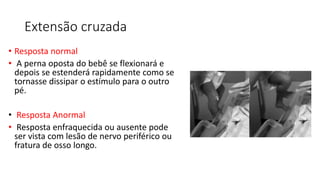 Extensão cruzada
• Resposta normal
• A perna oposta do bebê se flexionará e
depois se estenderá rapidamente como se
tornasse dissipar o estímulo para o outro
pé.
• Resposta Anormal
• Resposta enfraquecida ou ausente pode
ser vista com lesão de nervo periférico ou
fratura de osso longo.
 