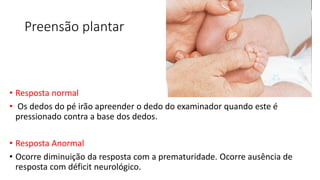 Preensão plantar
• Resposta normal
• Os dedos do pé irão apreender o dedo do examinador quando este é
pressionado contra a base dos dedos.
• Resposta Anormal
• Ocorre diminuição da resposta com a prematuridade. Ocorre ausência de
resposta com déficit neurológico.
 