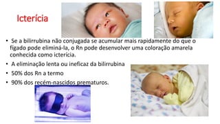 Icterícia
• Se a bilirrubina não conjugada se acumular mais rapidamente do que o
fígado pode eliminá-la, o Rn pode desenvolver uma coloração amarela
conhecida como icterícia.
• A eliminação lenta ou ineficaz da bilirrubina
• 50% dos Rn a termo
• 90% dos recém-nascidos prematuros.
 