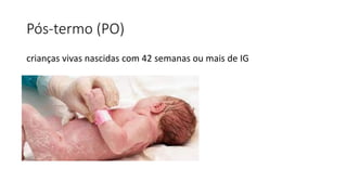 Pós-termo (PO)
crianças vivas nascidas com 42 semanas ou mais de IG
 