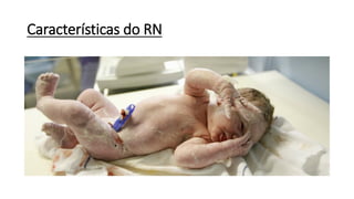 Características do RN
 