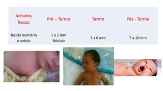 Achados
físicos
Pré – Termo Termo Pós - Termo
Tecido mamário
e aréola
1 a 2 mm
Nódulo
3 a 6 mm 7 a 10 mm
 