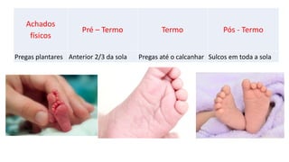 Achados
físicos
Pré – Termo Termo Pós - Termo
Pregas plantares Anterior 2/3 da sola Pregas até o calcanhar Sulcos em toda a sola
 