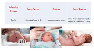 Achados
físicos
Pré – Termo Termo Pós - Termo
Cabelo Finos, aparência de lã. Sedosos, margem única.
Linha do cabelo anteriorizada.
Queda de cabelo, fino e curto.
 