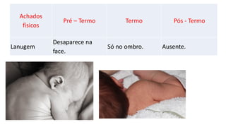 Achados
físicos
Pré – Termo Termo Pós - Termo
Lanugem
Desaparece na
face.
Só no ombro. Ausente.
 