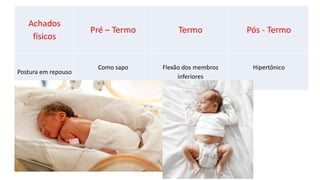 Achados
físicos
Pré – Termo Termo Pós - Termo
Postura em repouso
Como sapo Flexão dos membros
inferiores
Hipertônico
 