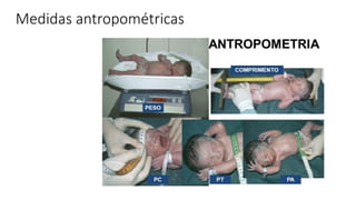 Medidas antropométricas
 