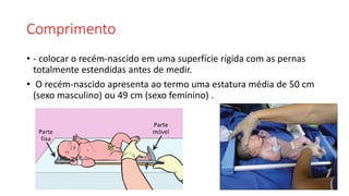 Comprimento
• - colocar o recém-nascido em uma superfície rígida com as pernas
totalmente estendidas antes de medir.
• O recém-nascido apresenta ao termo uma estatura média de 50 cm
(sexo masculino) ou 49 cm (sexo feminino) .
 