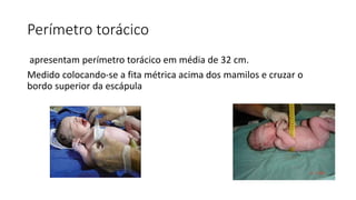 Perímetro torácico
apresentam perímetro torácico em média de 32 cm.
Medido colocando-se a fita métrica acima dos mamilos e cruzar o
bordo superior da escápula
 