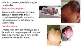 • Verificar presença de deformações
moldadas:
• bossa serossangüínea
(aumento de espessura do couro
cabeludo, geralmente difuso,
constituído de líquido plasmático
extravasado que se coleciona no
subcutâneo)
• cefalematoma
( massa mais bem delimitada, já que é
formada por sangue represado entre o
osso e o periósteo, que é fortemente
aderente na linha de sutura).
 