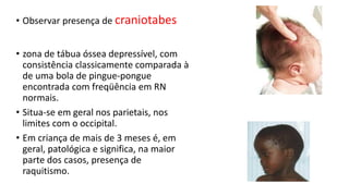 • Observar presença de craniotabes
• zona de tábua óssea depressível, com
consistência classicamente comparada à
de uma bola de pingue-pongue
encontrada com freqüência em RN
normais.
• Situa-se em geral nos parietais, nos
limites com o occipital.
• Em criança de mais de 3 meses é, em
geral, patológica e significa, na maior
parte dos casos, presença de
raquitismo.
 