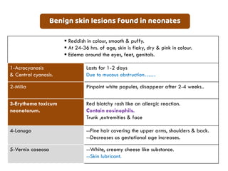 Vernox Rash Neonatal Examination | PDF