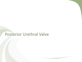 Posterior Urethral Valve
 