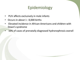 Epidemiology
• PUV affects exclusively in male infants
• Occurs in about 1 : 8,000 births
• Elevated incidence in African-Americans and children with
Down’s syndrome
• 10% of cases of prenatally diagnosed hydronephrosis overall
 