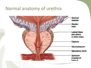 Normal anatomy of urethra
 