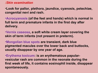 Vernox Rash NeonatologyNeonatologyNeonatology.Neonatologyppt | PPT