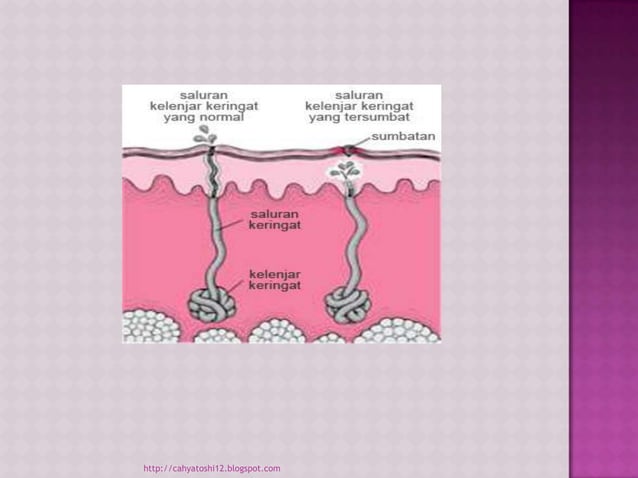 Asuhan Keperawatan Neonatus dengan Masalah Diaper Rash