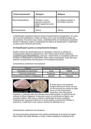 Tecido mesenquimal            Benignas                    Malignas


Não-hematopoiéticas          Recebem o nome              As malignas recebem a
                            segundo o tecido de          terminação "sarcoma
                            origem seguido do sufixo
                            "oma"

Hematopoiéticas:             Minoria                      Maioria


A classificação prognóstica aparece sempre acompanhada da histogenética. Às vezes,
não é possível estabelecer a origem da célula, tal é o grau de desdiferenciação que
ela apresenta. Em outros casos, ainda, o estabelecimento da classificação prognóstica
também é dificultoso, dada a complexidade de critérios de benignidade e malignidade,
os quais variam de tecido para tecido.

4.0 Classificações quanto ao comportamento biológico:

Existem critérios de classificação para as neoplasias conforme os padrões de
comportamento destas (se agressivas ou não). Esses critérios dizem respeito À
CLASSIFICAÇÃO PROGNÓSTICA, pela qual, basicamente, as neoplasias podem ser
divididas em BENIGNAS ou MALIGNAS. Dentro dessa classificação, esses dois tipos
possuem características macroscópicas e microscópicas peculiares:

Características anatômicas macroscópicas:

               Critérios               Neoplasias benignas     Neoplasias malignas
     Velocidade de crescimento                 Lenta                  Rápida
       Forma de crescimento                 Expansiva          Expansiva e infiltrativa
Crescimento à distância (metástases)         Ausente                 Presente




                                                  À direita vemos uma neoplasia
                                                  benigna (fibroma em útero), em que
                                                  se nota aumento de volume do órgão
                                                  como um todo (crescimento
                                                  expansivo), sem alteração de
superfície; a coloração está meio alterada (mais esbranquiçada, em decorrência do
acúmulo de fibras colágenas). À esquerda vemos um carcinoma em fígado, uma
neoplasia maligna. Olhe como é irregular a distribuição do tecido neoplásico
(mapeamento), parecendo infiltrar-se no tecido hepático (crescimento infiltrativo e
expansivo). A superfície é mais rugosa e também há alteração de cor.



Características anatômicas microscópicas:

Os tumores benignos apresentam suas células semelhantes às do tecido de origem.
Seus núcleos não estão alterados, ou seja, a célula neoplásica é indistinguível da
 
