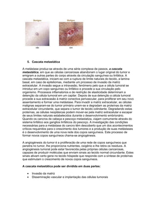 5. Cascata metastática

A metástase produz-se através de uma série complexa de passos, a cascata
metastática, em que as células cancerosas abandonam o lugar original do tumor e
emigram a outras partes do corpo através da circulação sanguínea ou linfática. A
cascata metastática, iniciam-se com a ruptura de limite naturais do tecido, a lamina
basal, em caso de epiteliomas, mediante um processo de invasão da matriz
extracelular. A invasão segue a intravasão, fenómeno pelo que a célula tumoral se
introduz em um copo sanguíneo ou linfático e procede a sua circulação pelo
organismo. Processos inflamatorios e de restrição de elasticidade determinam a
detenção da célula tumoral em um capilar. Depois de sua detenção a célula tumoral
procede a sua extravasão à matriz conectiva perivascular, para proliferar em seu novo
assentamento e formar uma metástase. Para invadir a matriz extracelular, as células
malignas separam-se do tumor primário unem-se e degradam as proteínas da matriz
extracelular circundante, que separa o tumor de tecido colindante. Degradando estas
proteínas, as células neoplásicas podem mover-se pela matriz extracelular e escapar
de seus limites naturais estabelecidos durante o desenvolvimento embrionário.
Quando os cancros de cabeça e pescoço metastatiza, viajam comumente através do
sistema linfático aos ganglios linfáticos do pescoço. A investigação das condições
necessárias para a metástase do cancro têm descoberto que um dos acontecimentos
críticos requeridos para o crescimento dos tumores e a produção de suas metástases
é o desenvolvimento de uma nova rede dos copos sanguíneos. Este processo de
formar novos copos sanguíneos chama-se angiogénesis.

A angiogénesis do tumor é a proliferacão de uma rede de copos sanguíneos que
penetra no tumor, lhe proporciona nutrientes, oxigénio e lhe retira os residuos. A
angiogénesis tumoral pode estar favorecida pelas próprias células cancerosas,
capazes de produzir moléculas que enviam sinais ao tecido normal circundante. Estes
sinais ativam certo gene no tecido hóspede que responde com a síntese de proteínas
que estimulam o crescimento de novos copos sanguíneos.

A cascata metastática pode ser dividida em duas partes:

   •   Invasão da matriz
   •   Disseminação vascular e implantação das células tumorais
 