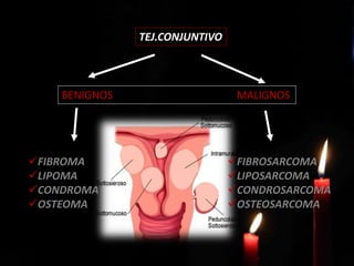 TEJ.CONJUNTIVO
BENIGNOS MALIGNOS
FIBROSARCOMA
LIPOSARCOMA
CONDROSARCOMA
OSTEOSARCOMA
FIBROMA
LIPOMA
CONDROMA
OSTEOMA
 