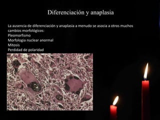Diferenciación y anaplasia
La ausencia de diferenciación y anaplasia a menudo se asocia a otros muchos
cambios morfológicos:
Pleomorfismo
Morfologia nuclear anormal
Mitosis
Perdidad de polaridad
 