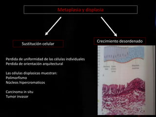 Metaplasia y displasia
Sustitución celular
Crecimiento desordenado
Perdida de uniformidad de las células individuales
Perdida de orientación arquitectural
Las células displasicas muestran:
Polimorfismo
Núcleos hipercromaticos
Carcinoma in situ
Tumor invasor
 