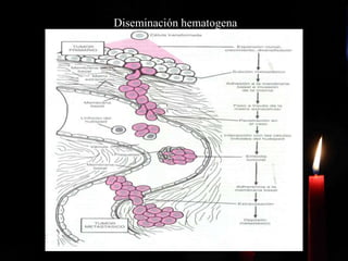 Diseminación hematogena
 