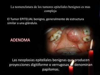 El Tumor EPITELIAL benigno, generalmente de estructura
similar a una glándula.
ADENOMA
Las neoplasias epiteliales benignas que producen
proyecciones digitiforme o verrugosas se denominan
papilomas.
La nomenclatura de los tumores epiteliales benignos es mas
compleja
 