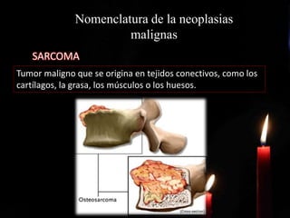 Nomenclatura de la neoplasias
malignas
Tumor maligno que se origina en tejidos conectivos, como los
cartílagos, la grasa, los músculos o los huesos.
SARCOMA
 