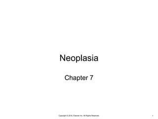 Copyright © 2018, Elsevier Inc. All Rights Reserved.
Neoplasia
Chapter 7
1
 