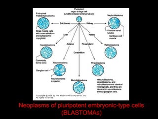 neoplasia.pptx