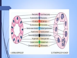 neoplasia , carcinogenesis, tumour market